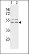 Vitronectin antibody, PA5-14370, Invitrogen Antibodies, Western Blot image 