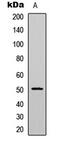 Calcium/Calmodulin Dependent Protein Kinase II Alpha antibody, MBS8218549, MyBioSource, Western Blot image 