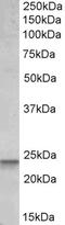 Fanconi anemia group F protein antibody, 42-618, ProSci, Enzyme Linked Immunosorbent Assay image 