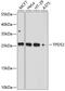 Tumor Protein D52 antibody, A03949, Boster Biological Technology, Western Blot image 