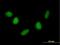 Nudix Hydrolase 6 antibody, H00011162-B01P, Novus Biologicals, Immunocytochemistry image 