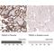 Transmembrane protein 2 antibody, NBP1-94168, Novus Biologicals, Immunohistochemistry paraffin image 