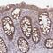 Glutathione S-Transferase Mu 1 antibody, NBP2-46828, Novus Biologicals, Immunohistochemistry paraffin image 