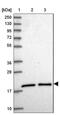 Ubiquitin Conjugating Enzyme E2 G1 antibody, NBP2-13499, Novus Biologicals, Western Blot image 