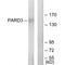 Par-3 Family Cell Polarity Regulator antibody, A01897, Boster Biological Technology, Western Blot image 