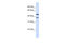 Transmembrane Protein 135 antibody, ARP49773_P050, Aviva Systems Biology, Western Blot image 