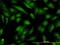 Guided Entry Of Tail-Anchored Proteins Factor 3, ATPase antibody, H00000439-M03, Novus Biologicals, Immunofluorescence image 