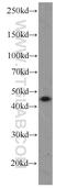 Dual Specificity Phosphatase 9 antibody, 10826-1-AP, Proteintech Group, Western Blot image 