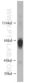Serpin Family A Member 3 antibody, 12192-1-AP, Proteintech Group, Western Blot image 