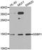 Single Stranded DNA Binding Protein 1 antibody, A6987, ABclonal Technology, Western Blot image 