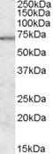 Microtubule Affinity Regulating Kinase 2 antibody, EB08426, Everest Biotech, Western Blot image 