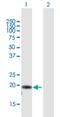 Adaptor Related Protein Complex 3 Subunit Sigma 2 antibody, H00010239-B01P, Novus Biologicals, Western Blot image 