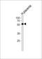 Zinc Finger Protein 71 antibody, PA5-35188, Invitrogen Antibodies, Western Blot image 