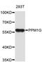 Protein Phosphatase, Mg2+/Mn2+ Dependent 1G antibody, STJ25079, St John