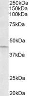 Actin Related Protein 2/3 Complex Subunit 1A antibody, TA311362, Origene, Western Blot image 