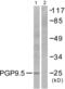 Ubiquitin C-Terminal Hydrolase L1 antibody, abx013178, Abbexa, Western Blot image 