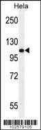Androgen Receptor antibody, 61-403, ProSci, Western Blot image 