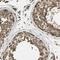 FLII Actin Remodeling Protein antibody, NBP1-87926, Novus Biologicals, Immunohistochemistry paraffin image 