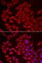 1-Acylglycerol-3-Phosphate O-Acyltransferase 2 antibody, PA5-76010, Invitrogen Antibodies, Immunofluorescence image 