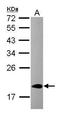 Cold Inducible RNA Binding Protein antibody, GTX120184, GeneTex, Western Blot image 