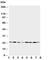 O-6-Methylguanine-DNA Methyltransferase antibody, R30479, NSJ Bioreagents, Western Blot image 