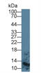 S100 Calcium Binding Protein A8 antibody, abx131996, Abbexa, Western Blot image 