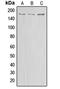 ATP Binding Cassette Subfamily A Member 8 antibody, orb214980, Biorbyt, Western Blot image 