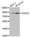 Forkhead Box O3 antibody, abx005866, Abbexa, Western Blot image 