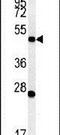 Ectonucleotide Pyrophosphatase/Phosphodiesterase 6 antibody, PA5-25140, Invitrogen Antibodies, Western Blot image 