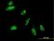 Heart- and neural crest derivatives-expressed protein 2 antibody, H00009464-M05, Novus Biologicals, Immunofluorescence image 