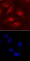 Coactivator Associated Arginine Methyltransferase 1 antibody, AF7277, R&D Systems, Immunofluorescence image 