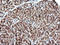 Parvin Alpha antibody, LS-C174629, Lifespan Biosciences, Immunohistochemistry paraffin image 