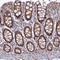 TGF-Beta Activated Kinase 1 (MAP3K7) Binding Protein 1 antibody, NBP2-38458, Novus Biologicals, Immunohistochemistry paraffin image 