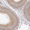 Vacuolar protein sorting-associated protein 45 antibody, NBP1-81641, Novus Biologicals, Immunohistochemistry paraffin image 