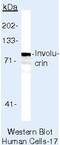 Involucrin antibody, MA5-11803, Invitrogen Antibodies, Western Blot image 