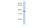 Transmembrane Protein 173 antibody, 26-276, ProSci, Western Blot image 