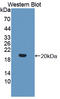 Interleukin 17 Receptor B antibody, LS-C374733, Lifespan Biosciences, Western Blot image 