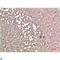 Transthyretin antibody, LS-C813246, Lifespan Biosciences, Immunohistochemistry paraffin image 