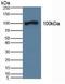 Amine Oxidase Copper Containing 1 antibody, LS-C297553, Lifespan Biosciences, Western Blot image 