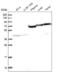 Lysine Acetyltransferase 2A antibody, NBP2-14140, Novus Biologicals, Western Blot image 