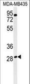 Ras Related GTP Binding D antibody, LS-C162765, Lifespan Biosciences, Western Blot image 