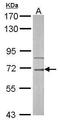 Interleukin 1 Receptor Associated Kinase 3 antibody, TA308809, Origene, Western Blot image 