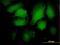 Arrestin Beta 2 antibody, H00000409-M06, Novus Biologicals, Immunocytochemistry image 