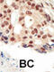 Protein Kinase CGMP-Dependent 2 antibody, abx033809, Abbexa, Immunohistochemistry paraffin image 