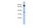 Coiled-Coil Serine Rich Protein 1 antibody, GTX45133, GeneTex, Western Blot image 