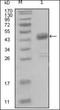 Discoidin Domain Receptor Tyrosine Kinase 1 antibody, orb89220, Biorbyt, Western Blot image 