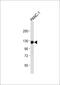 Receptor Tyrosine Kinase Like Orphan Receptor 1 antibody, A03192, Boster Biological Technology, Western Blot image 