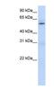 Protein Arginine Methyltransferase 3 antibody, NBP1-55399, Novus Biologicals, Western Blot image 