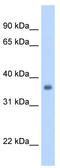 Sarcoglycan Gamma antibody, TA334659, Origene, Western Blot image 