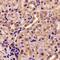 Adenylate Kinase 4 antibody, LS-C482345, Lifespan Biosciences, Immunohistochemistry paraffin image 